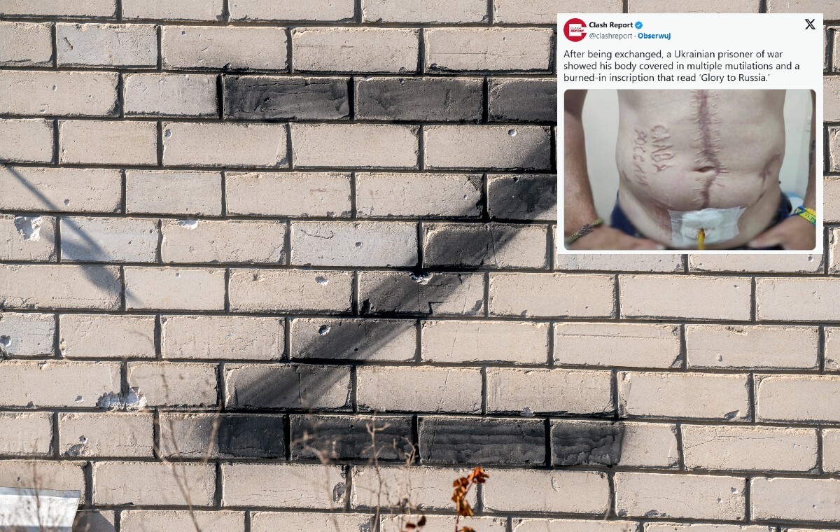 Bestialstwo! Rosjanie wypalili napis "Chwała Rosji" na ciele