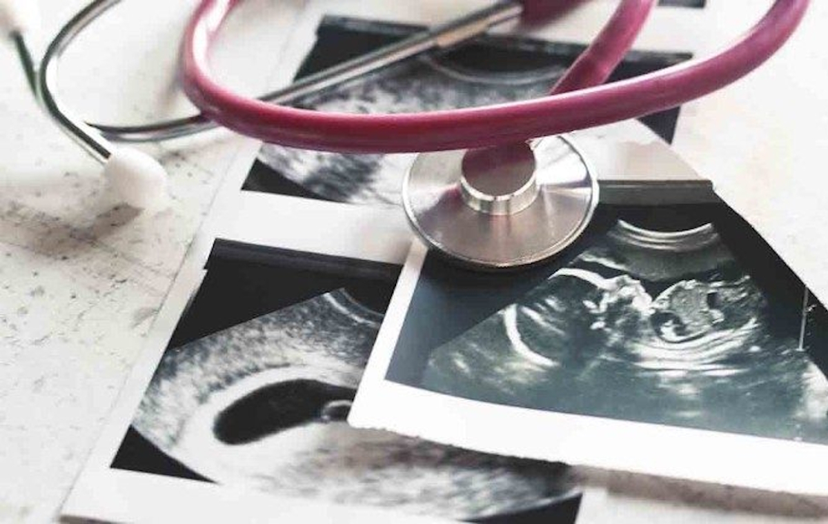 Tragiczny rekord w Irlandii. Trzykrotny wzrost aborcji