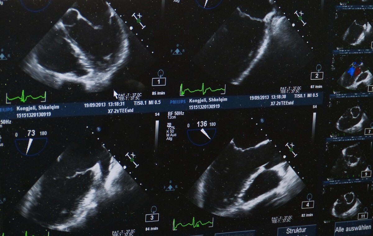 Od 1991 r. zamknięto 70 proc. klinik aborcyjnych w USA