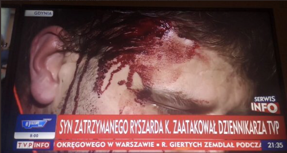 autor: TVP Info