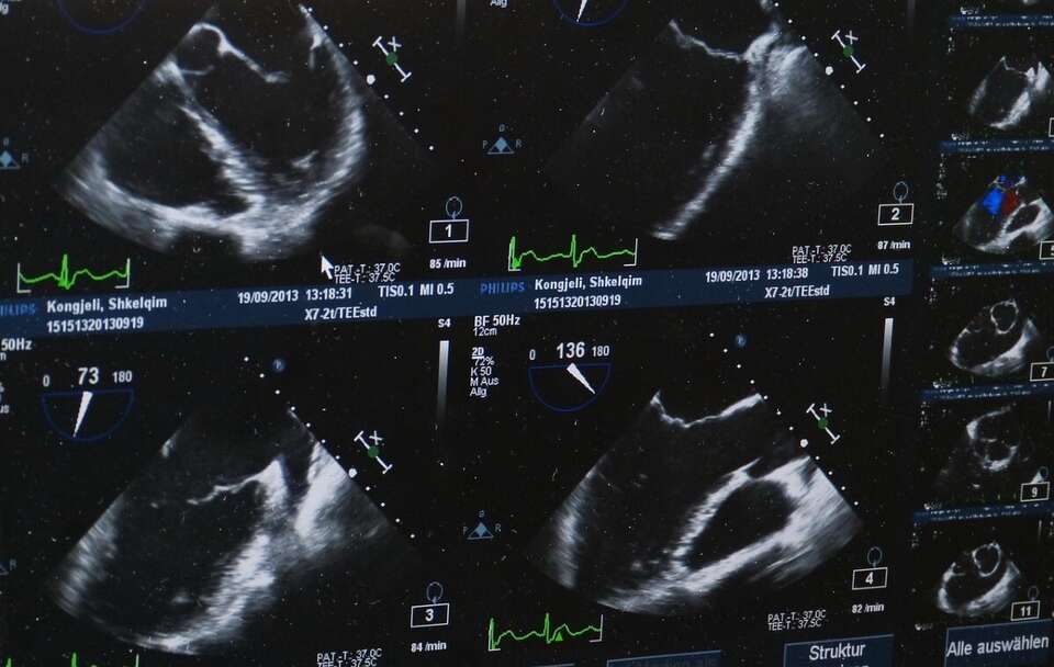 Od 1991 r. zamknięto 70 proc. klinik aborcyjnych w USA