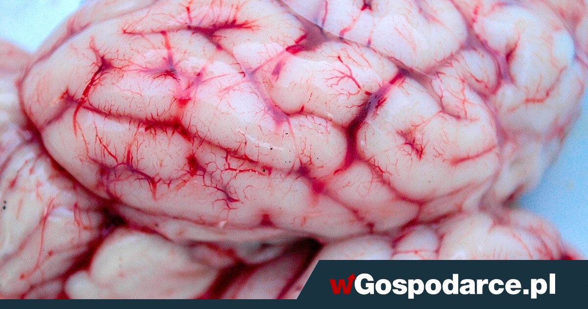 Ile masz plastiku w mózgu? Znamy odpowiedź