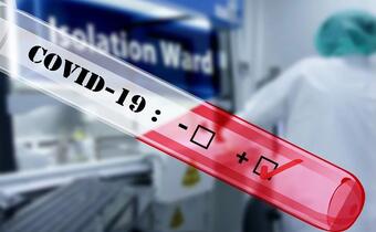 Szybkie testy na koronawirusa trafią do Służby Zdrowia