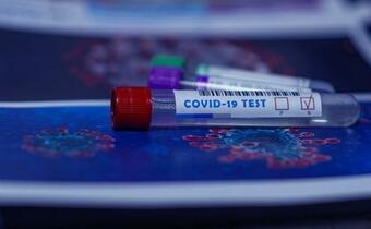 Test odporności na COVID-19 zbada kilka rodzajów przeciwciał