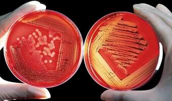 Szef WHO: świat nic nie robi, żeby zapobiec kolejnej epidemii