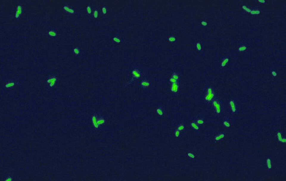 Fluoryzujące komórki bakterii Legionella pneumophila wyznakowanych przeciwciałami / autor: wikimedia commons/CDC-PHIL - from german wikipedia/Domena publiczna