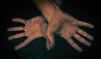 Choroba brudnych rąk wciąż powszechna