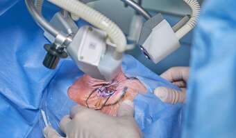 Dieta może zmniejszać ryzyko zaćmy