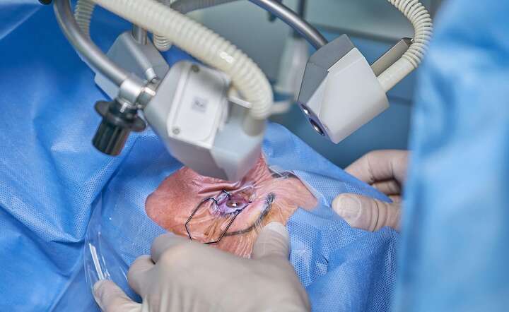 Leczenie zaćmy wymaga interwencji okulistycznej przy użyciu lasera / autor: Pixabay