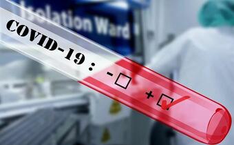 Niemcy: Koniec bezpłatnych testów na koronawirusa