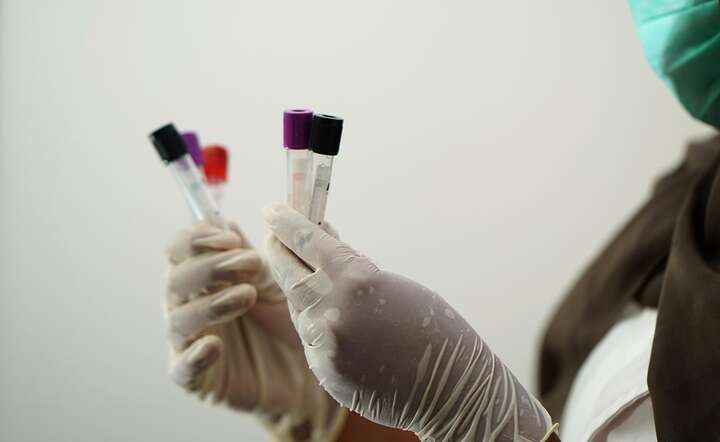 Kolejne laboratoria badają osobę z podejrzeniem cholery / autor: Pixabay