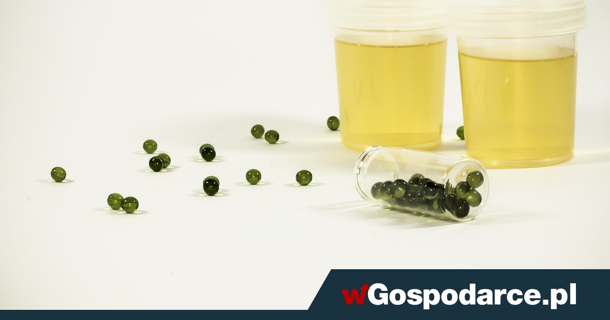 Mocz – czego możemy się z niego dowiedzieć?