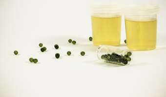 Mocz – czego możemy się z niego dowiedzieć?