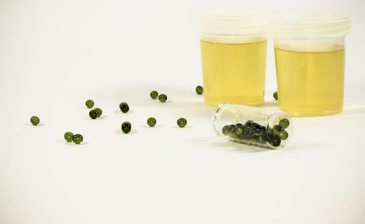 Mocz, często postrzegany jako produkt uboczny, stanowi w rzeczywistości dynamiczny profil biochemiczny organizmu / autor: Pixabay