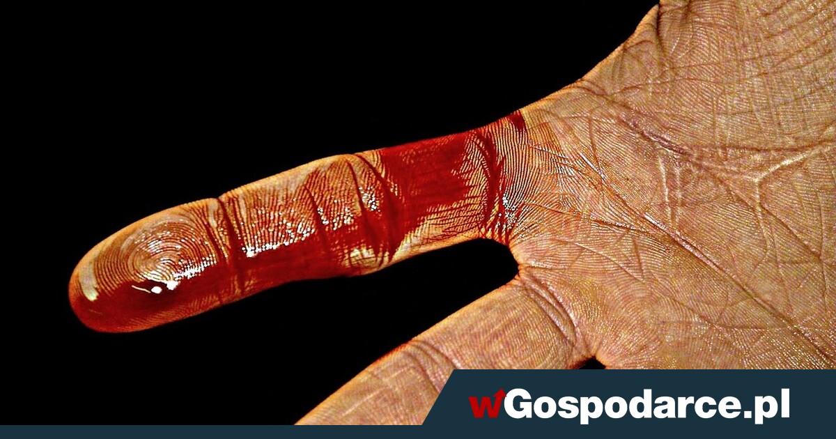 Skaleczenie? Zobacz w jaki sposób goją się rany